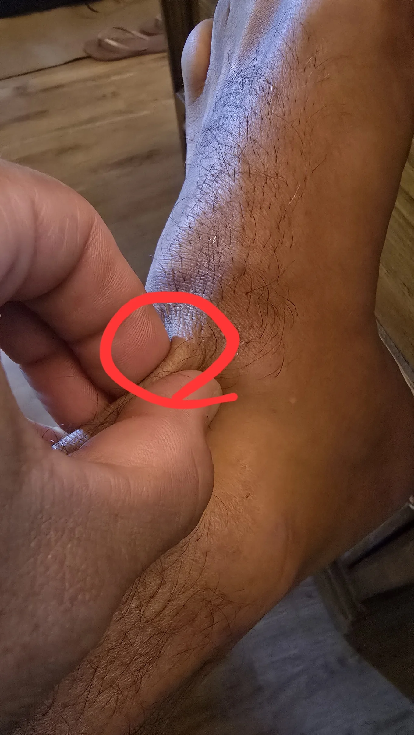 Highlighted is the site of injection since my issue is when I flex the toes towards the ankle 