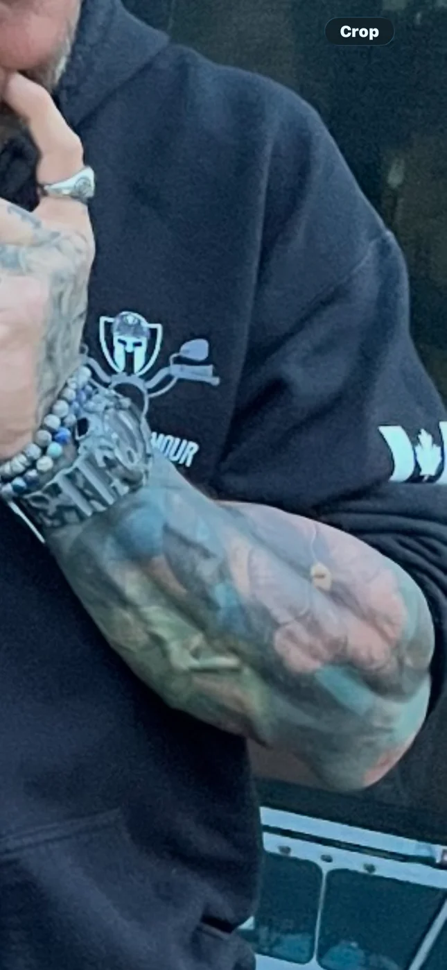 19Jul Forearm progress.webp