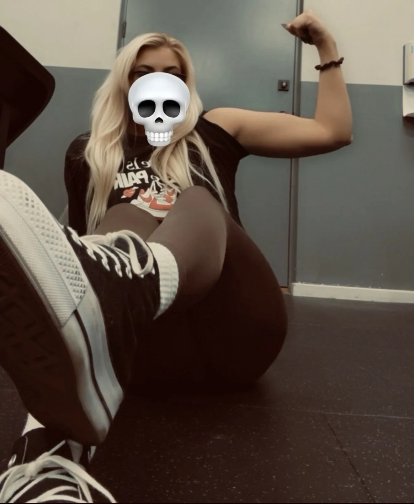 bicep lump 1.webp