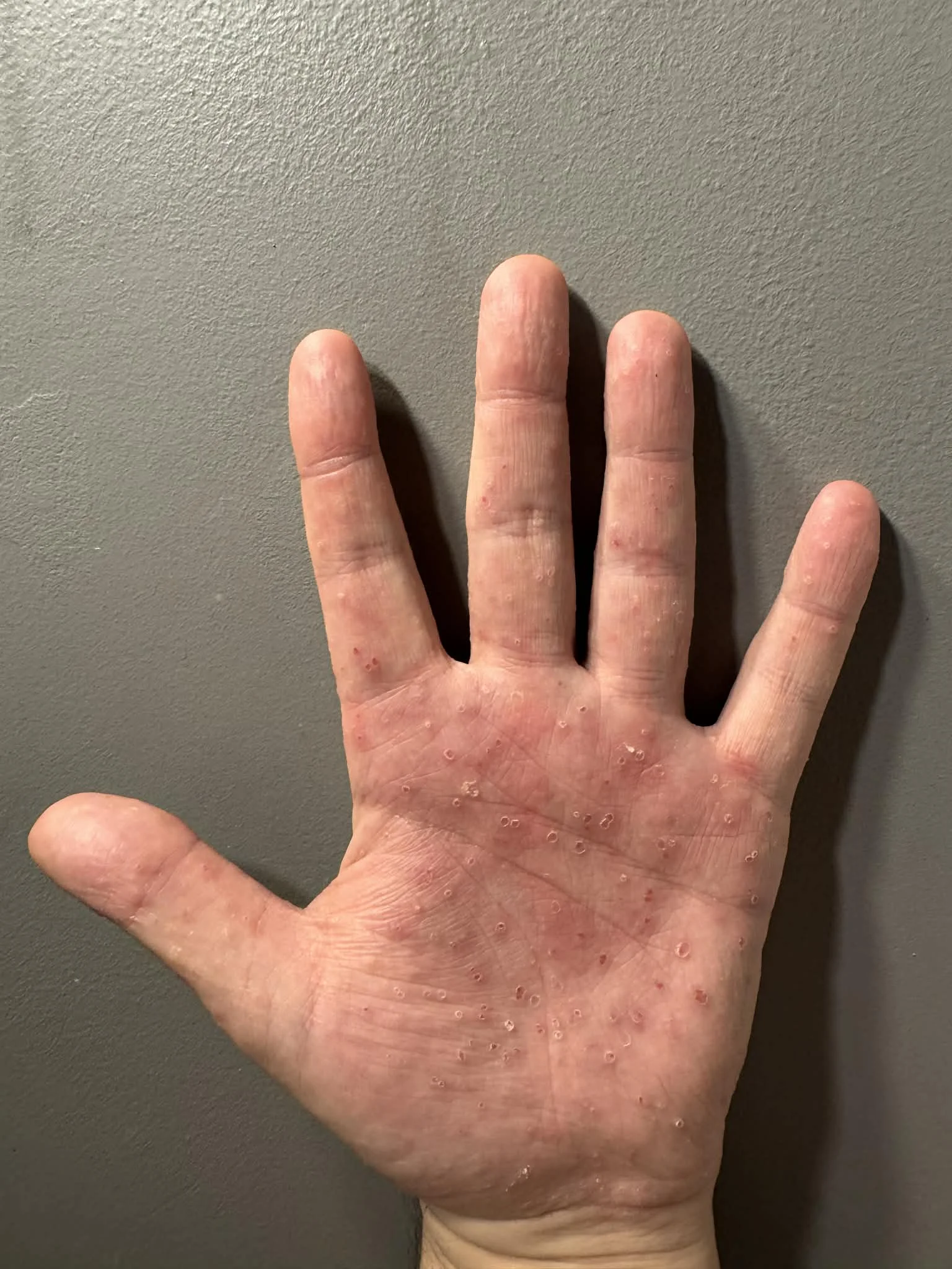 day_one_hands_left.webp