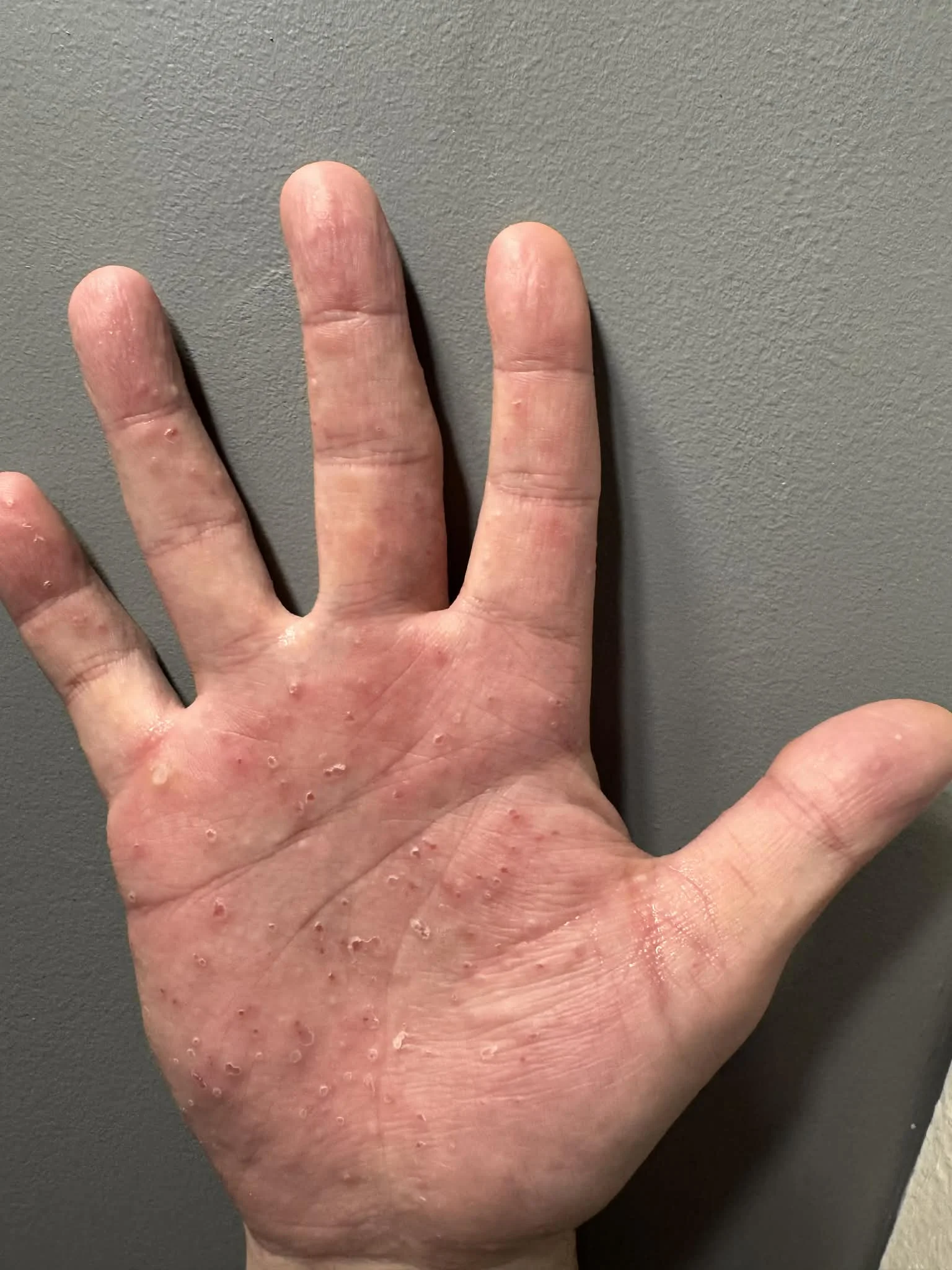 day_one_hands_right.webp