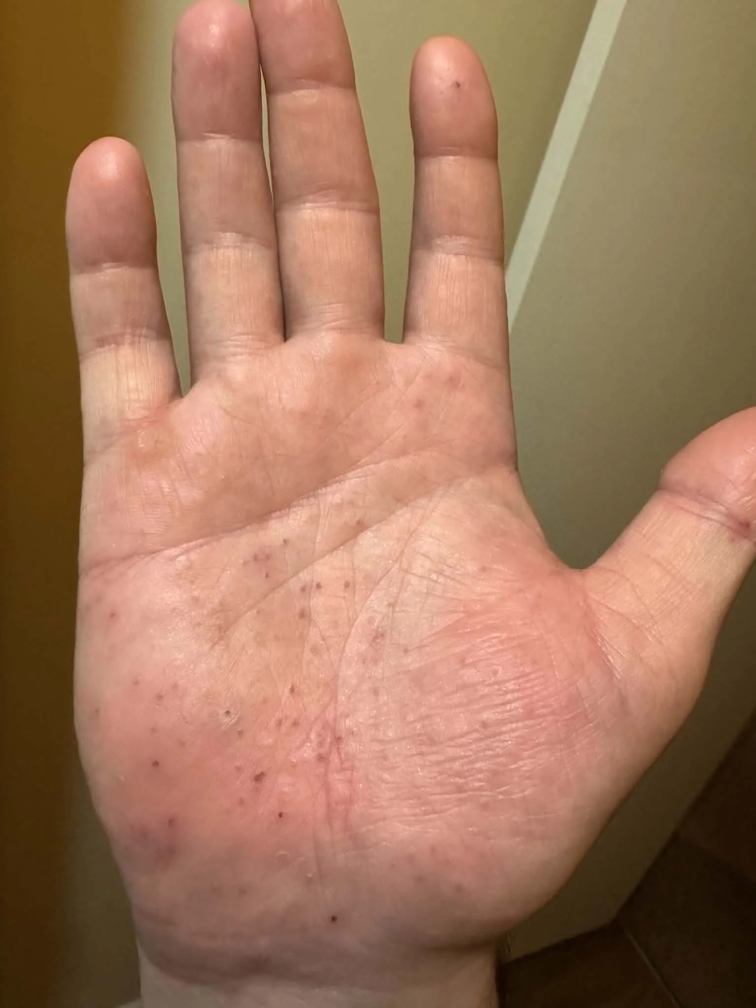 healing_day_three_right.webp