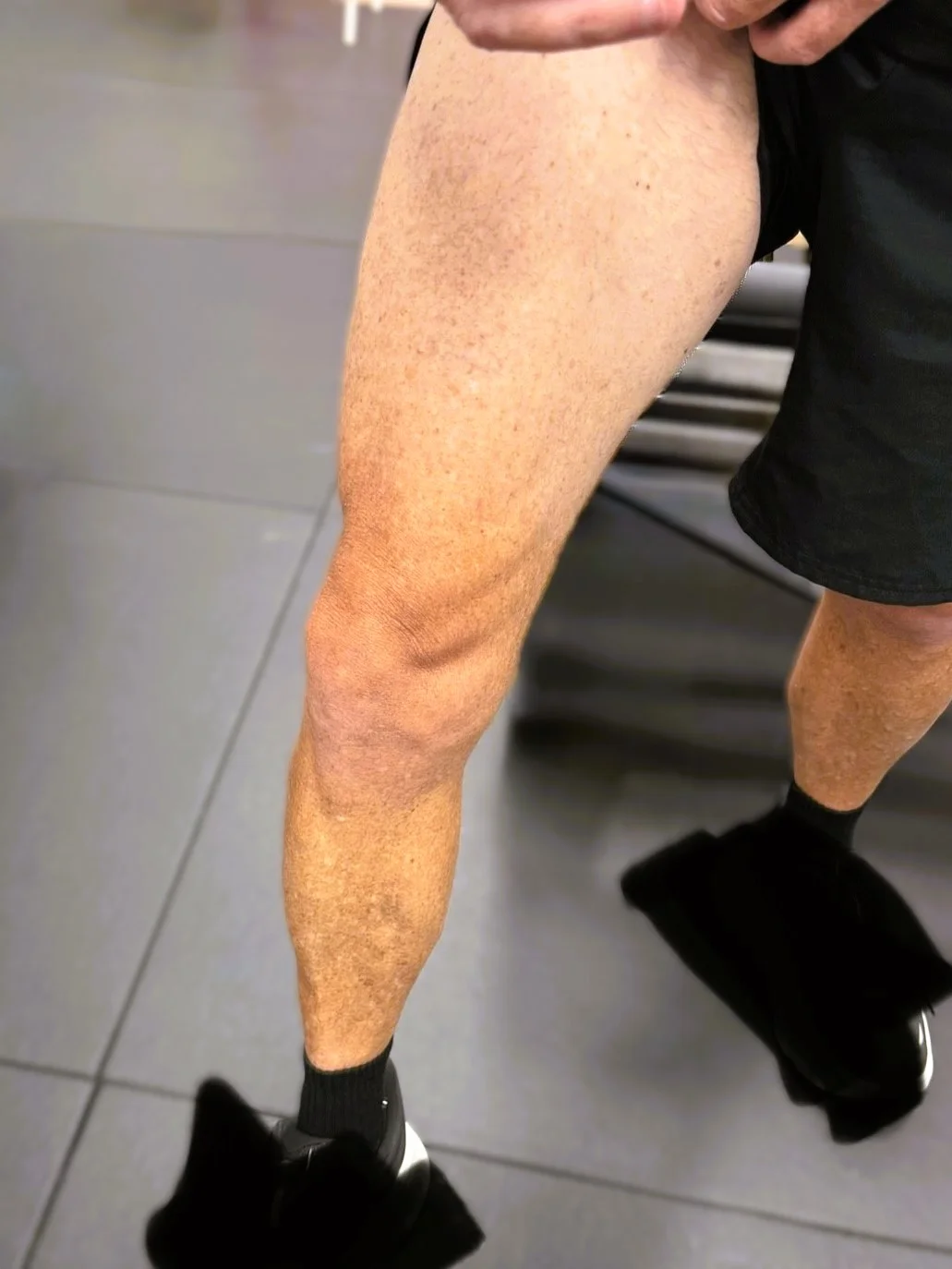 Leg.webp