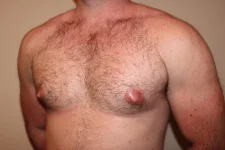 gyno.webp