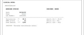 Screenshot_20250430_130934_OneDrive.webp