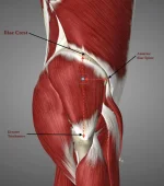 VG INJECTION POINT.webp