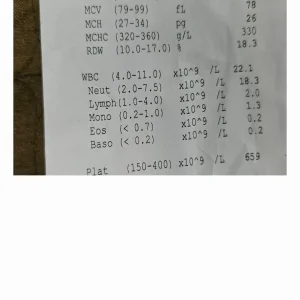 Bloods when on antibiotics _1.webp