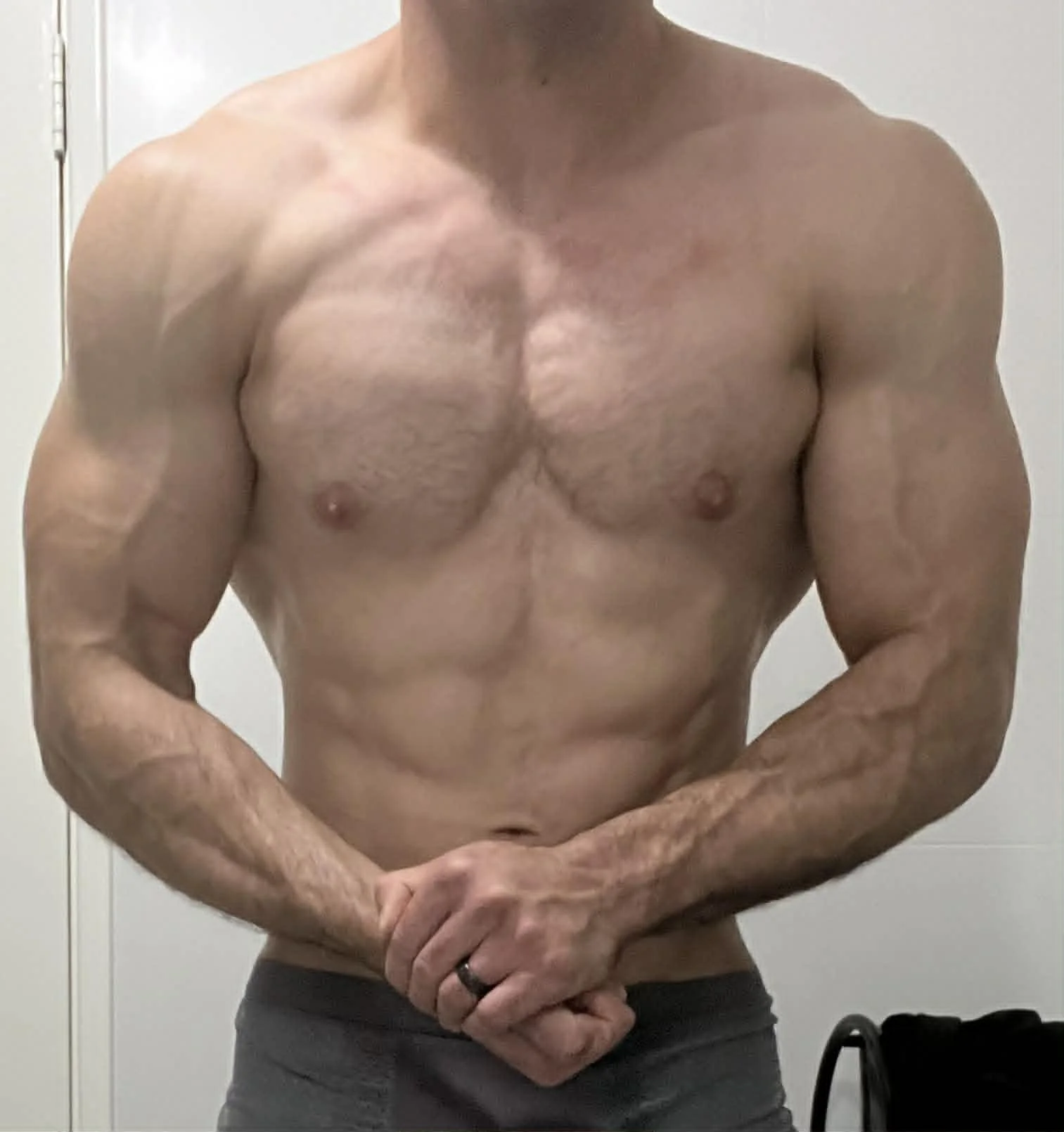 gyno.webp