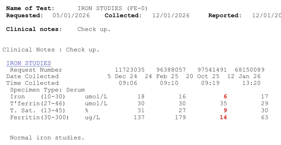 Iron Studies.webp