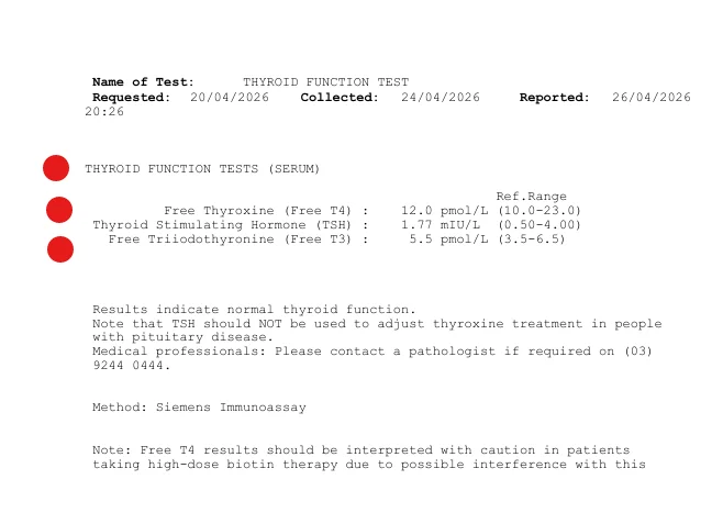 TRT Thyroid.webp