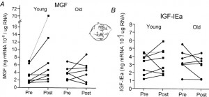 mgf vs IGF-IEa