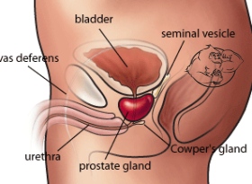 prostate damage