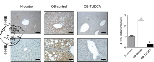 tudca liver lipids