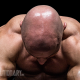 Steroids-and-Hair-Loss