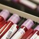 doping in sport