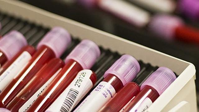 doping in sport