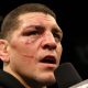 nick diaz