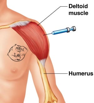 Shoulder anabolic steroid injection technique