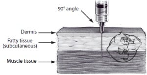 Injection Sites For Intramuscular Injections