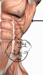 injections into lats