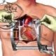 CT Fletcher open heart surgery