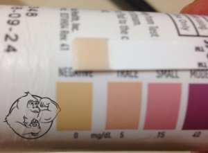 day 10 keto strip after eating