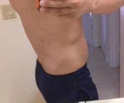 day 6 picture and acne