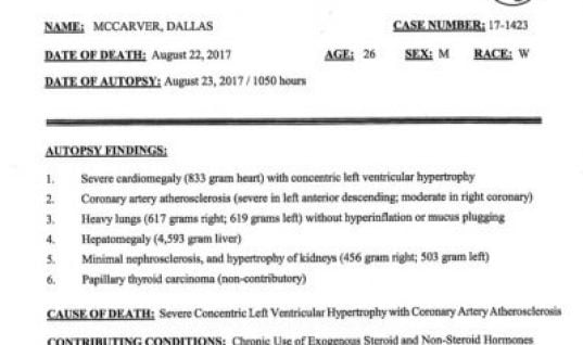 dallas-autopsy-findings