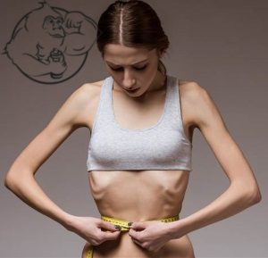 Anorexia