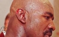 Evander Holyfield ear