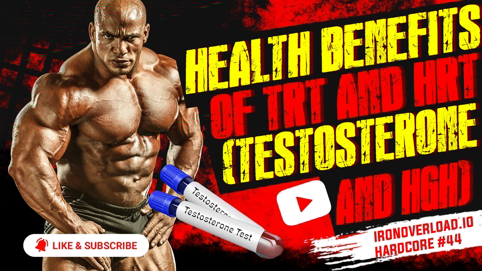 TRT