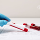How supplements can help your bloodwork improve?